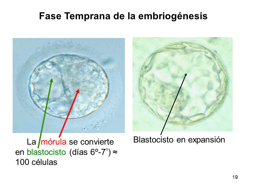 La enfermedad la eccema seca el tratamiento